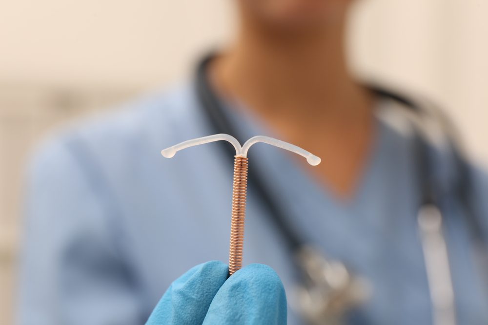 Copper IUD